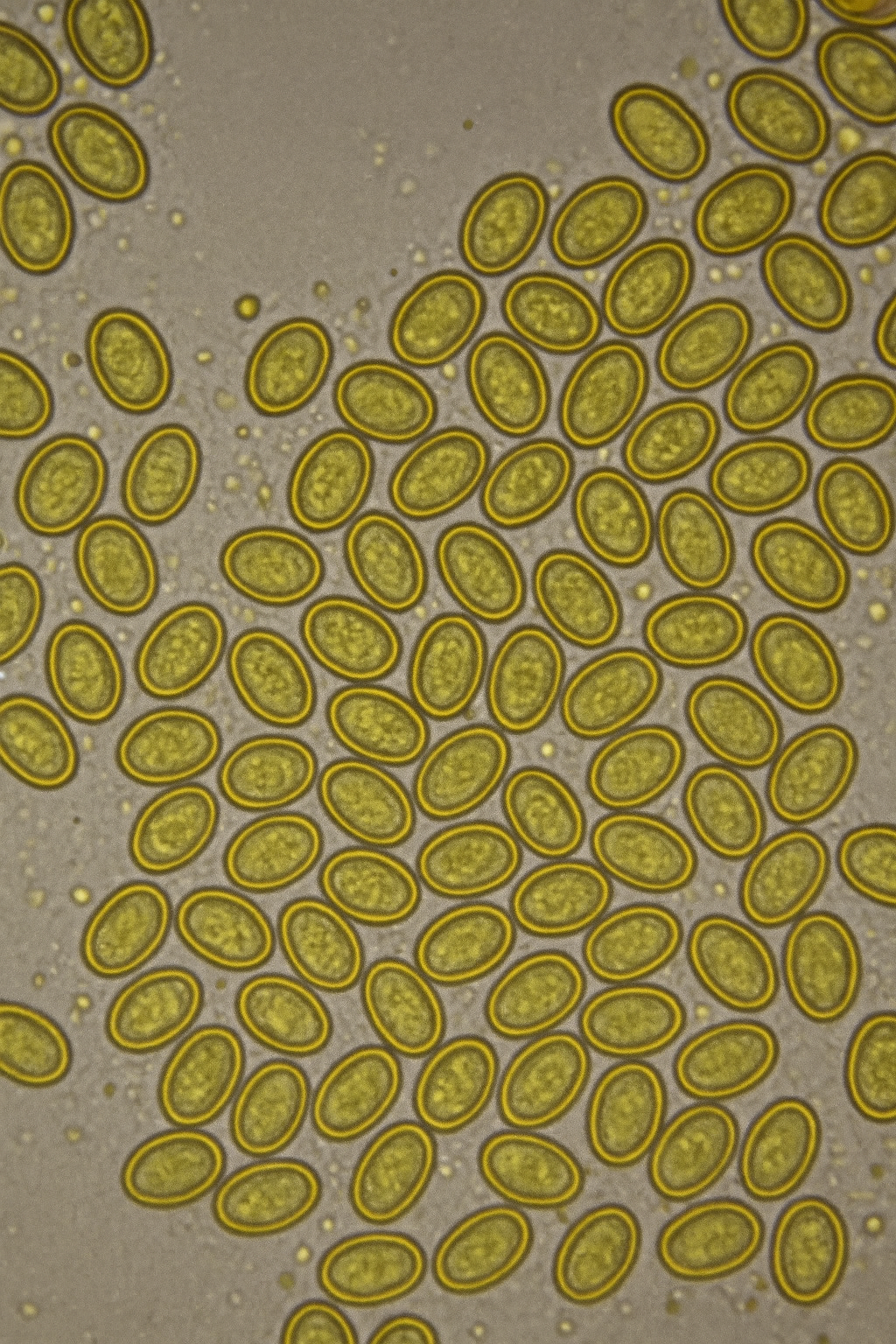 Чем опасен грибок для человека?