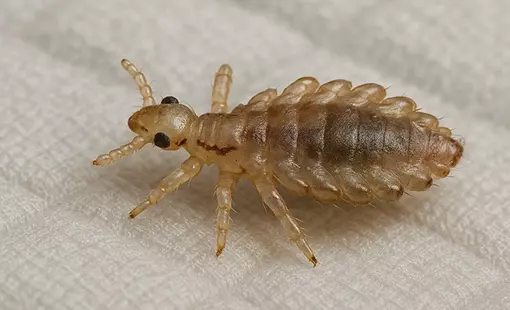 Как выглядят вши?